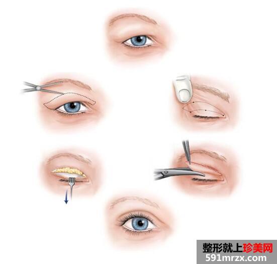 沈阳蓝天整形医院2017新价格表出炉