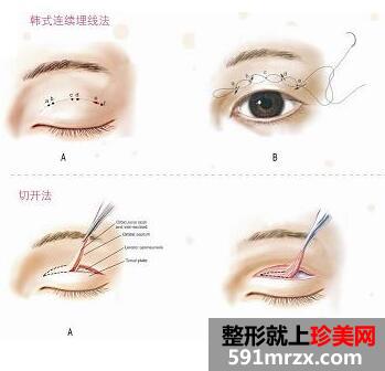 淄博向东整形医院价格表2017一览