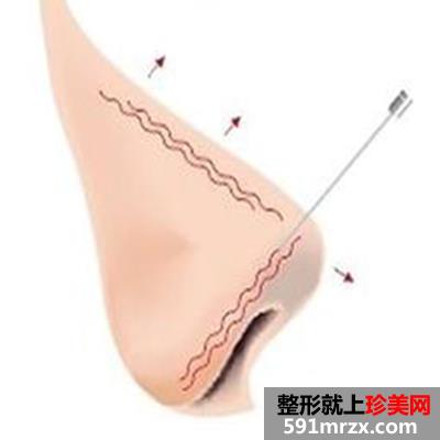 石家庄星源整形医院2017价格表新曝光