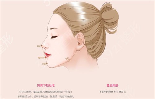 国内下颌角手术权威医生排名如下