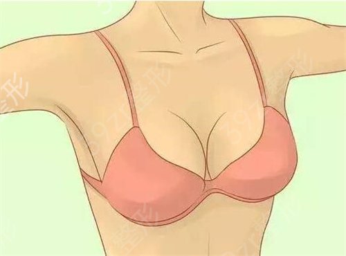 精挑细选的在金华芘丽芙做假体隆胸