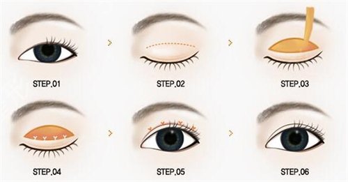 济宁口碑好整形医院有哪些