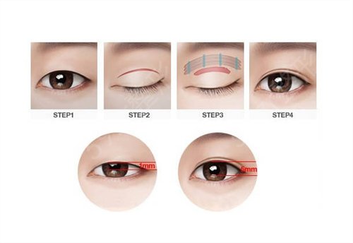 哈尔滨正规的整形医院有哪些