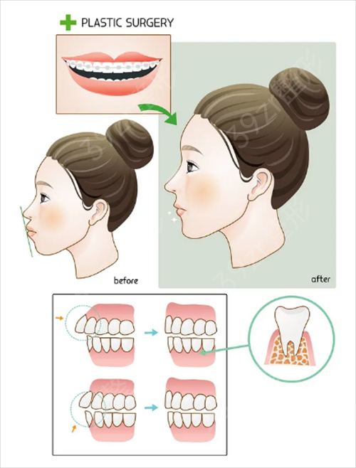 西安牙齿整形医院排行榜前四名单发布