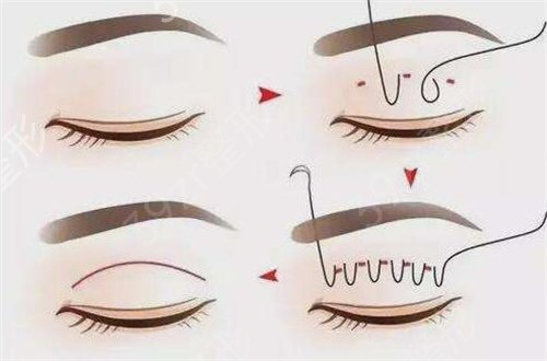 赣州整形医院排名前三哪家好