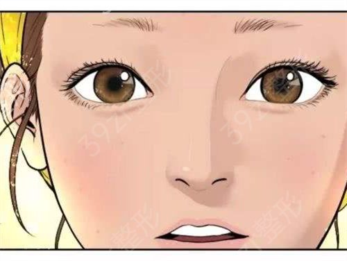 浙江哪个医生割双眼皮好